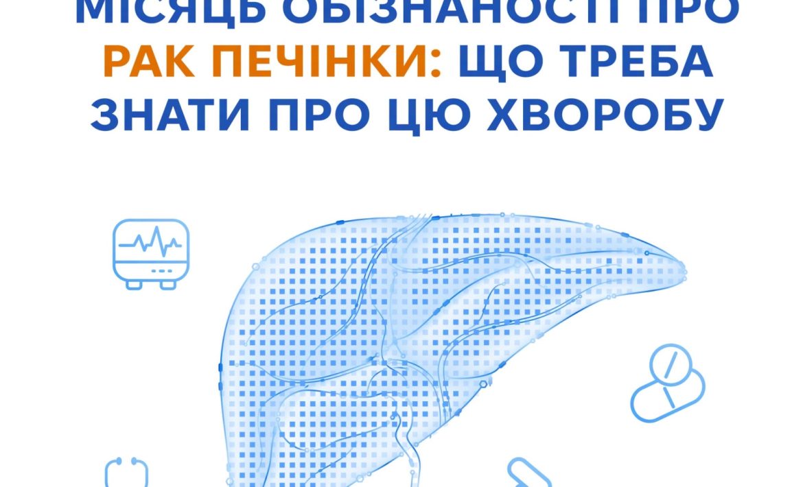 Рак печінки посідає сьоме місце за поширеністю серед онкологічних захворювань